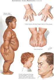 آکندروپلازی